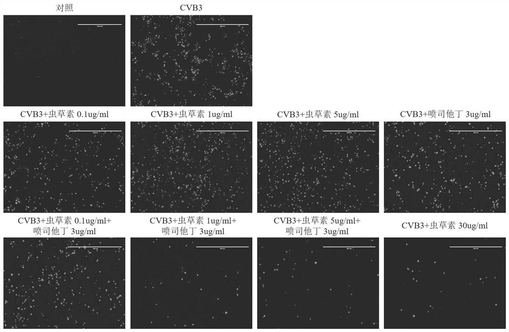 Application of cordyceps militaris pharmaceutical composition in preparation of preparation for preventing and/or treating novel coronaviruses and resisting respiratory viruses