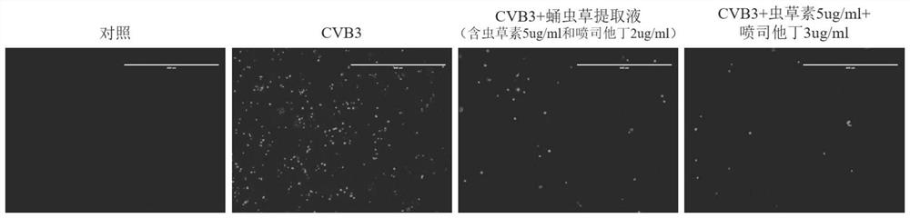 Application of cordyceps militaris pharmaceutical composition in preparation of preparation for preventing and/or treating novel coronaviruses and resisting respiratory viruses