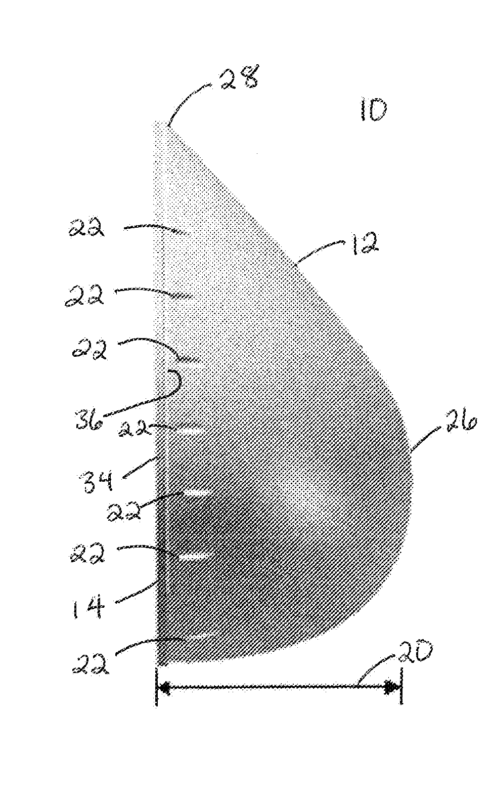 Breast Reconstruction Device and Methods