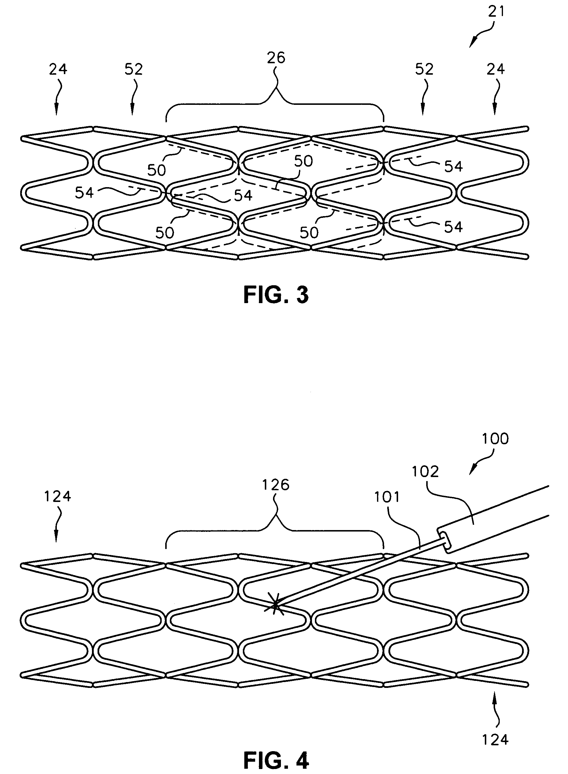 Endoluminal stent having a matched stiffness region and/or a stiffness gradient and methods for providing stent kink resistance