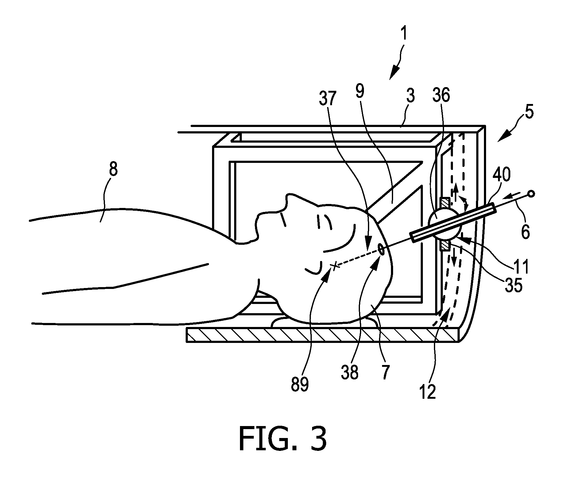 Instrument guiding during magnetic resonance imaging