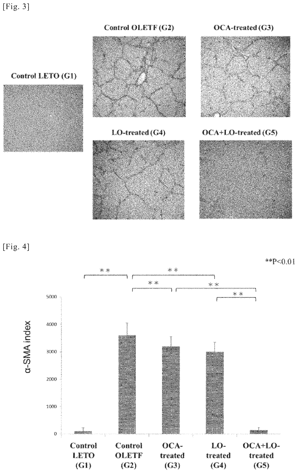 Medicine obtained by combining FXR agonist and ARB