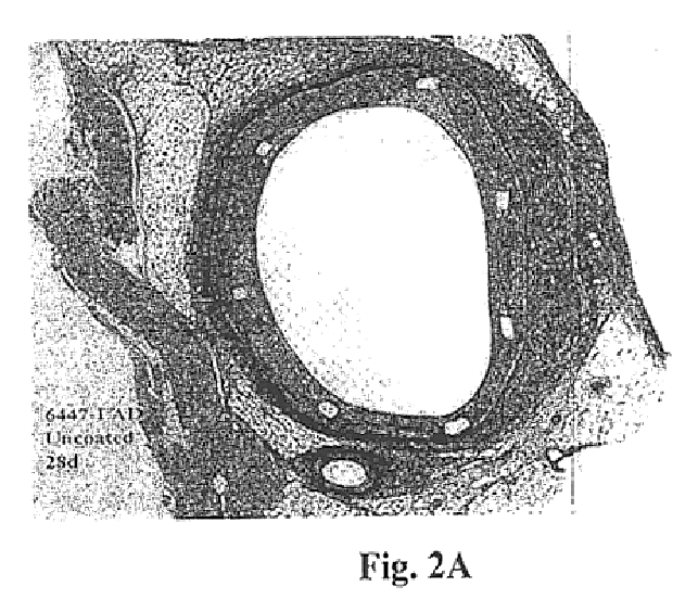 Drug delivery compositions and medical devices containing block copolymer