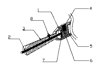 Medical self-coagulation knife