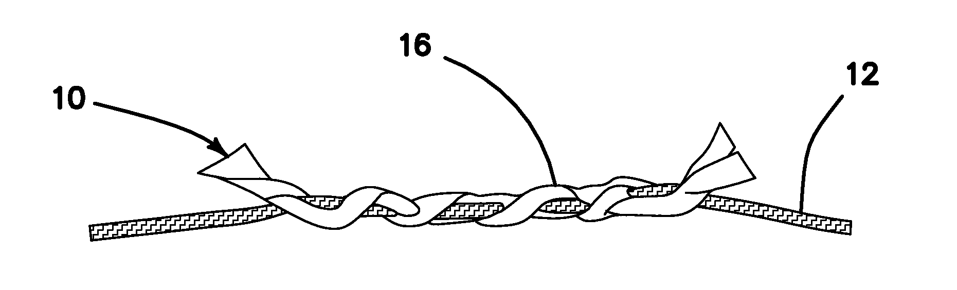 All-suture suture anchor systems and methods