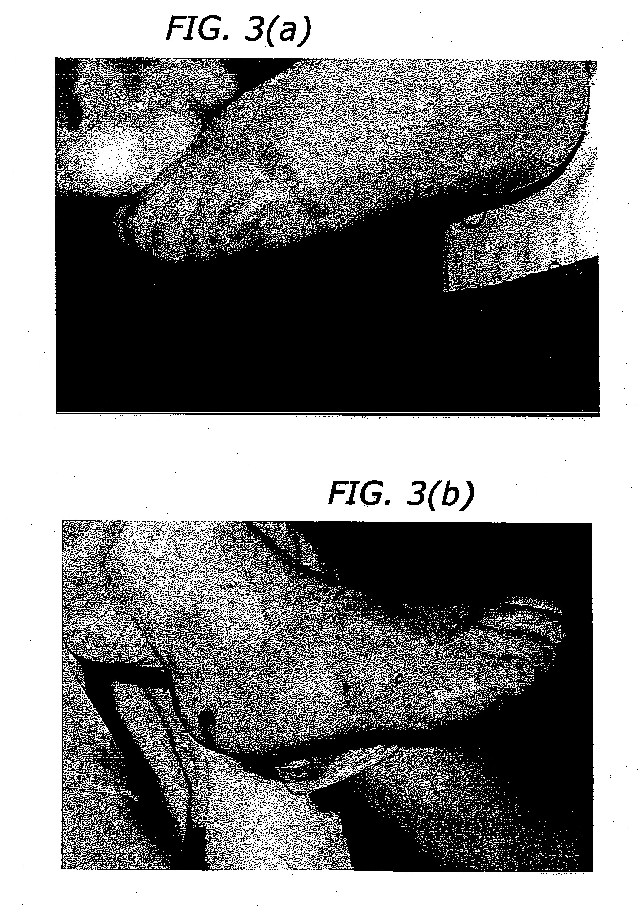 Methods for treatment of inflammatory diseases