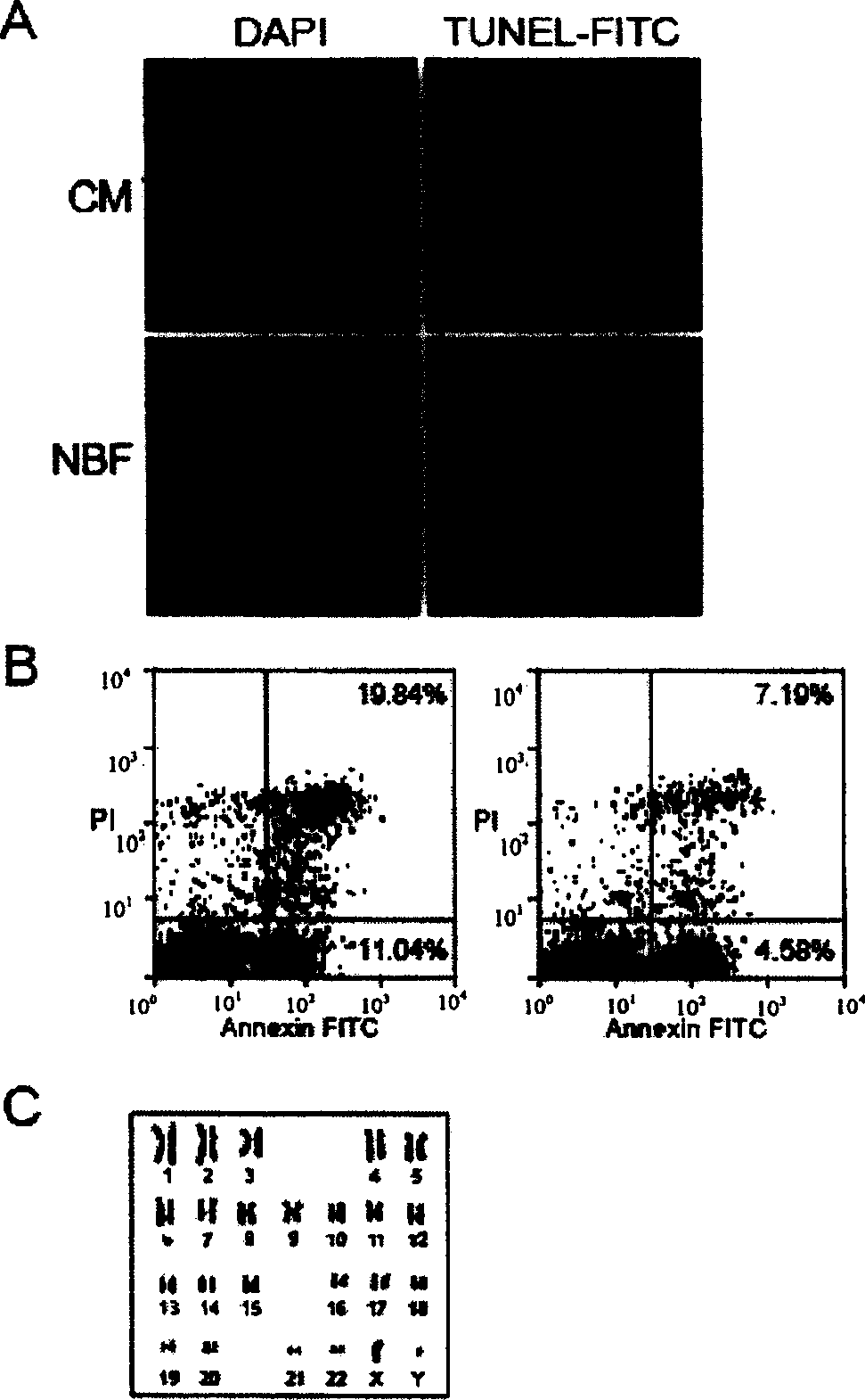 A culturing method of human embryonic stem cells and a special culturing medium thereof