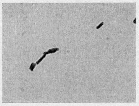 Lactobacillus fermentum strain and its application