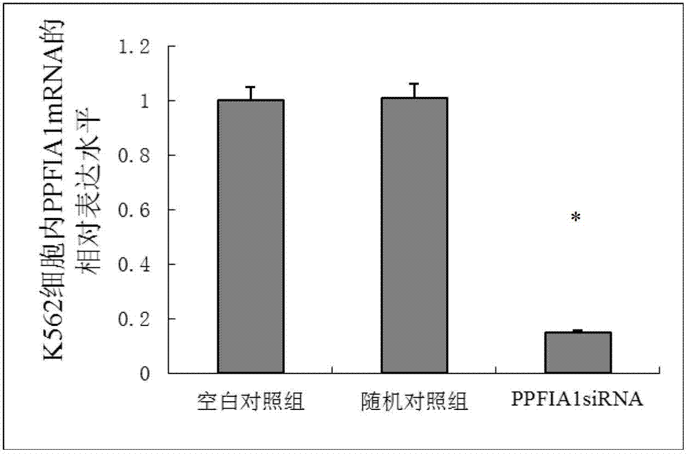 SiRNA inhibiting PPFIA1 gene expression, and its application
