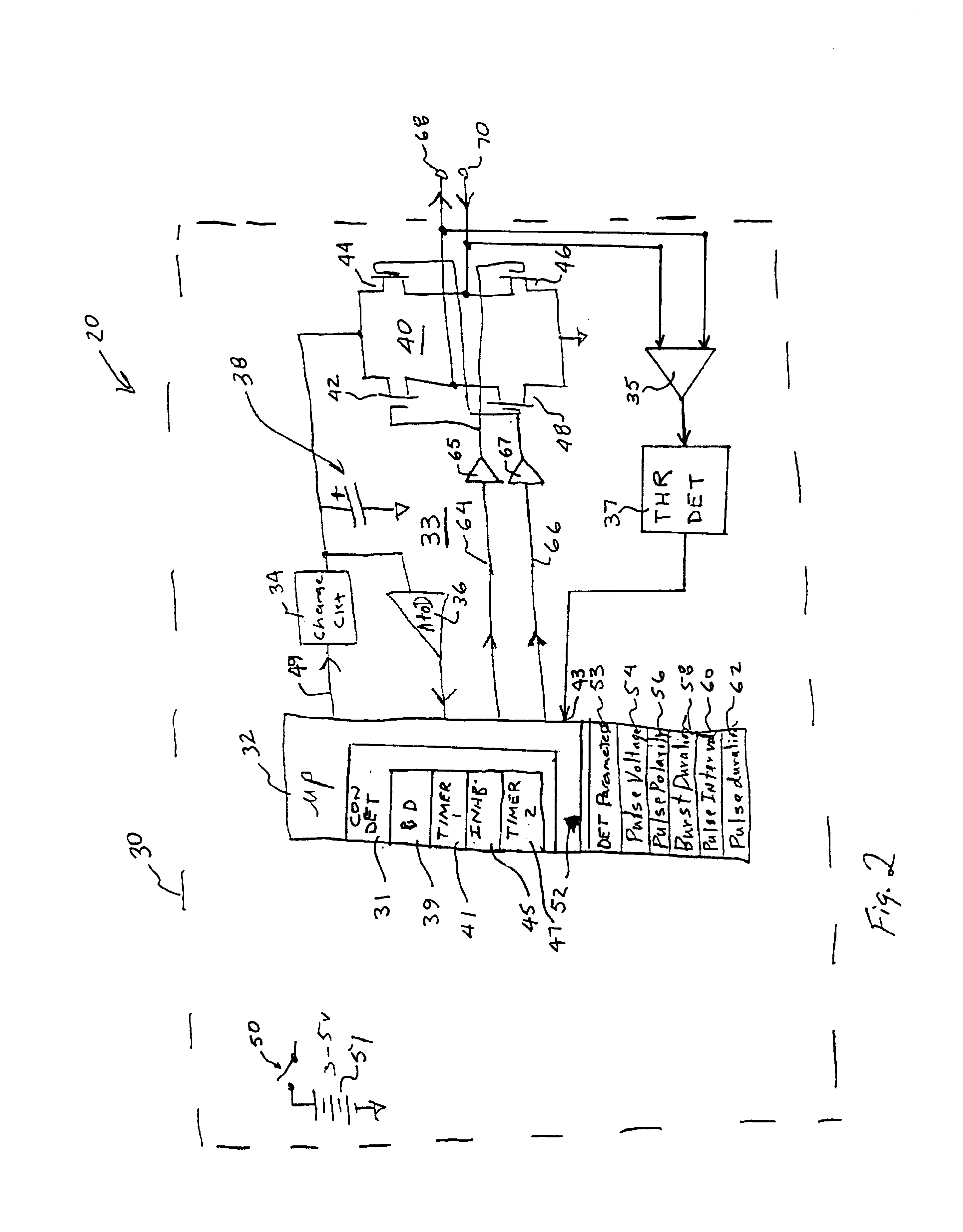 Uterine contraction detection and initiation system and method