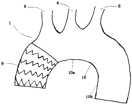 Aortic-arch-with-branch covered stent blood vessel combined device