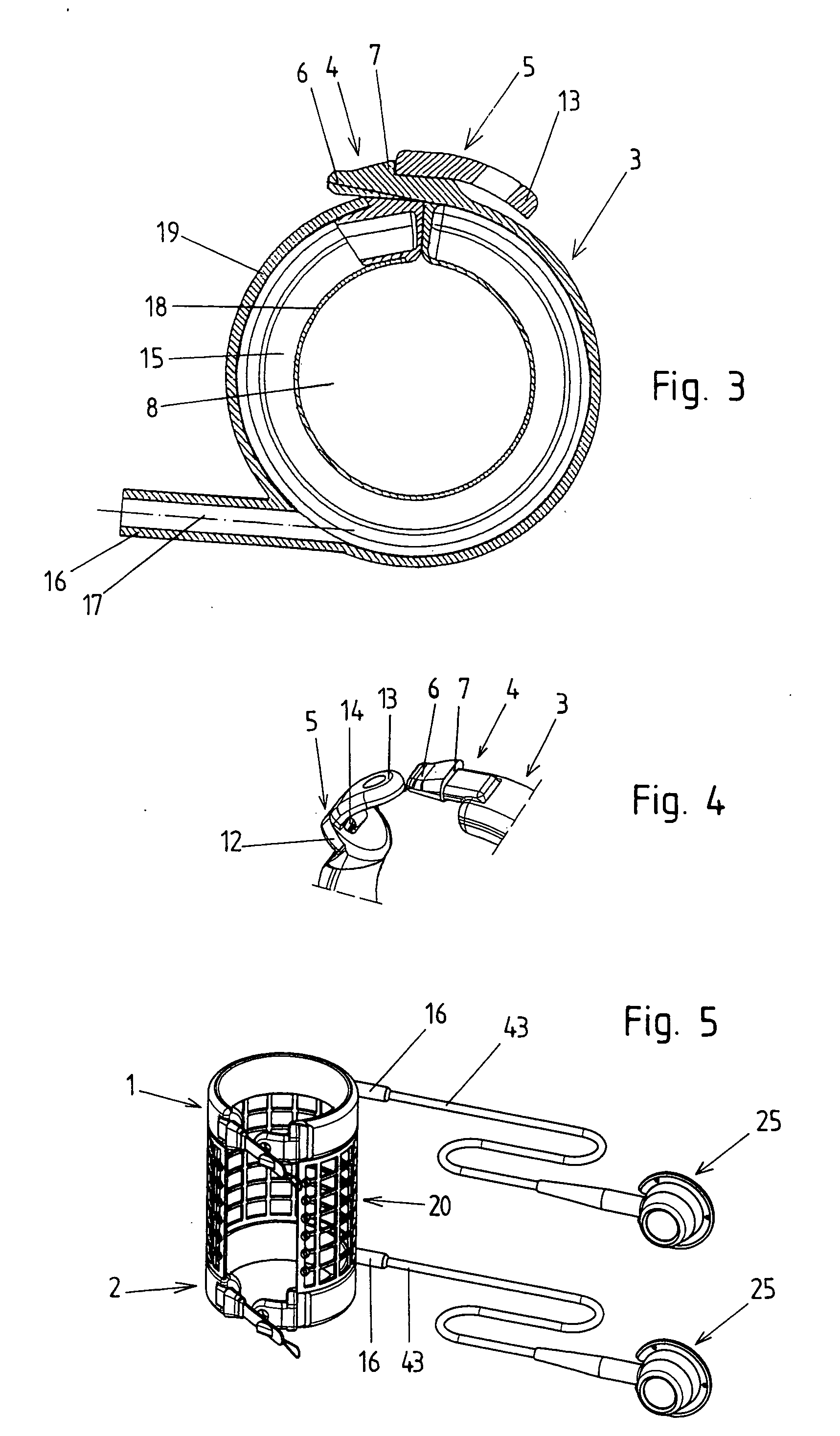 Device for the treatment of obesity