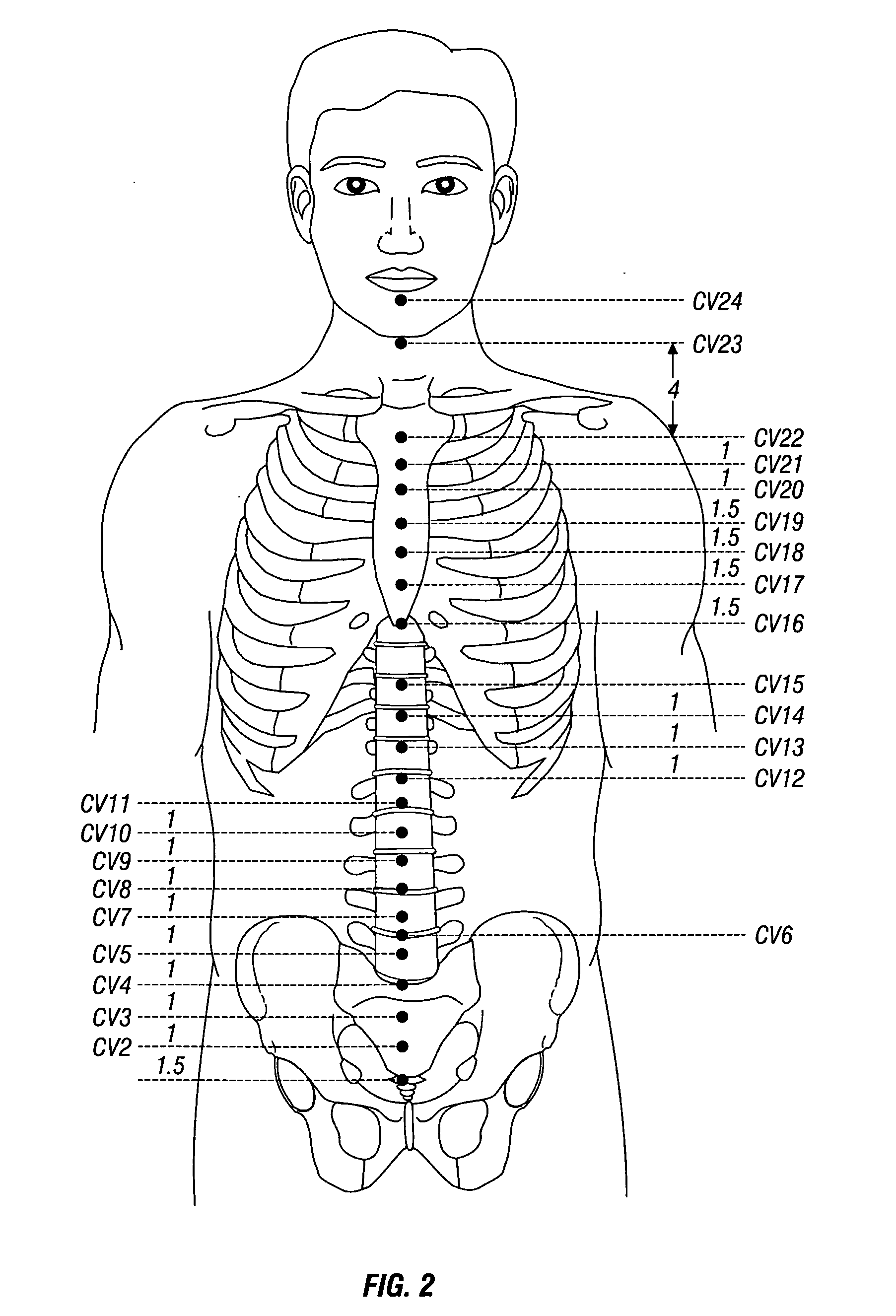 Method for energy-based stimulation of acupuncture meridians