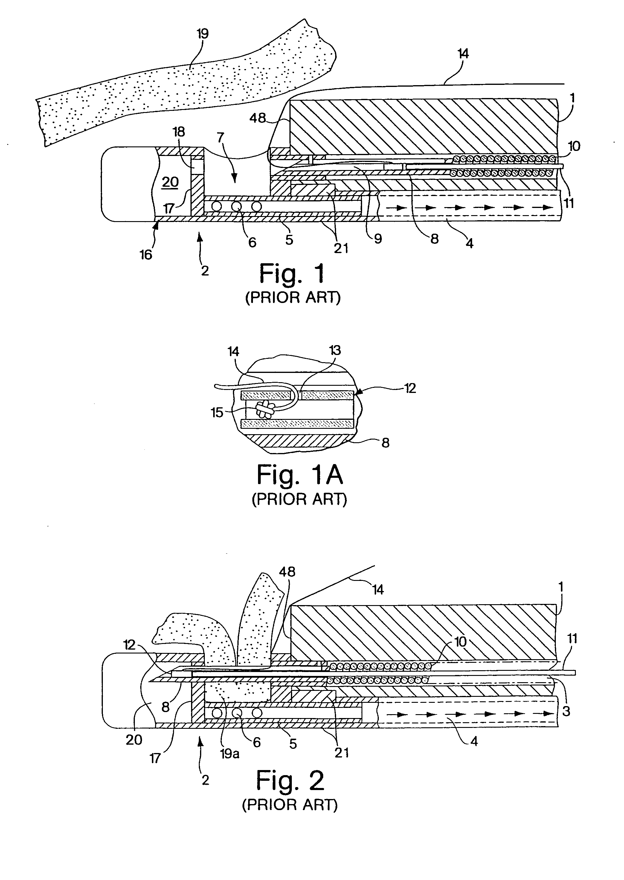 Endoscopic tissue apposition device with multiple suction ports