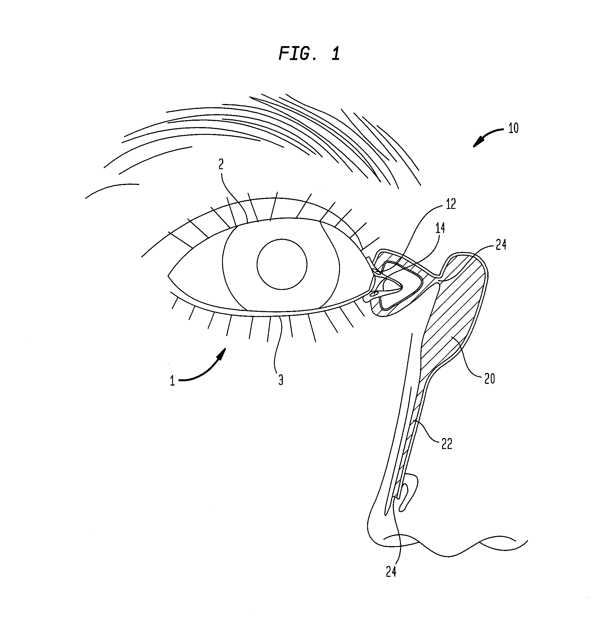 Microelectronic biosensor plug