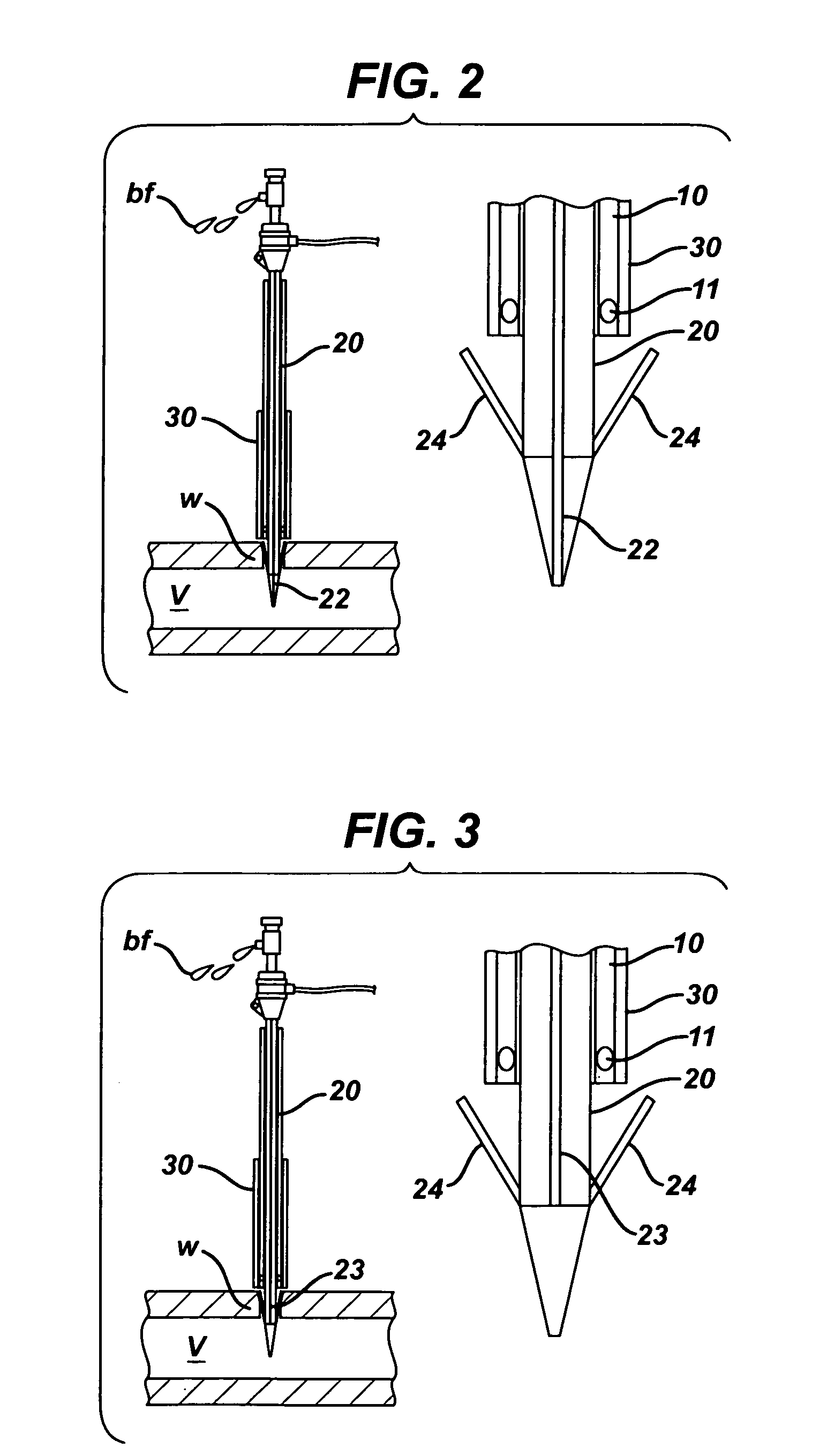 Systems and methods for closing a vessel wound