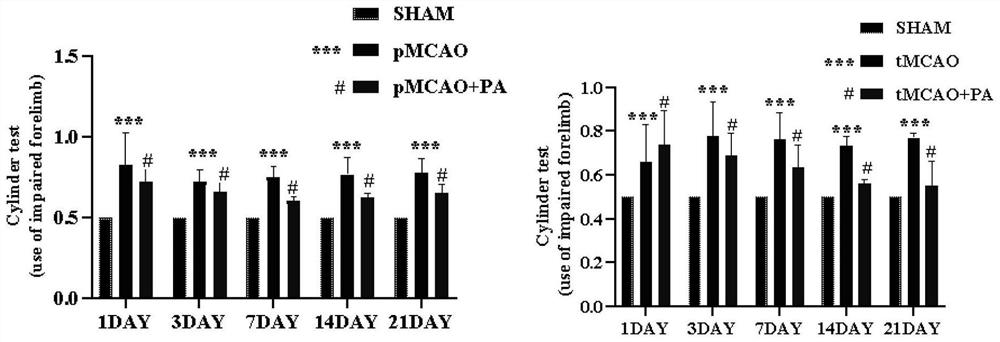 Application of periplaneta americana extract in preparation of cerebral apoplexy recovery product