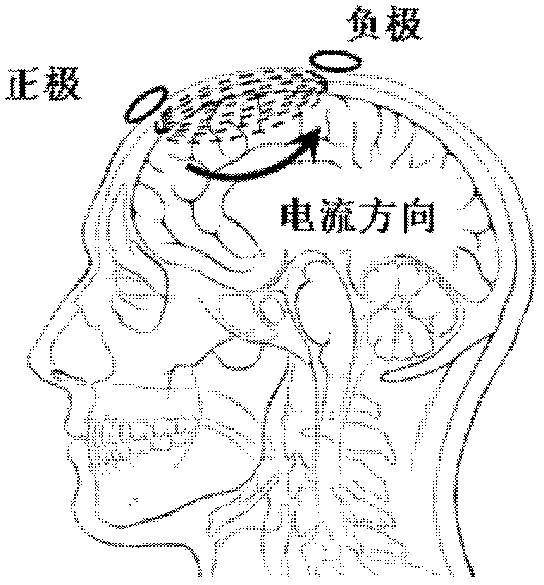 High-focusing-capability multi-channel transcranial direct current stimulation device and control method thereof