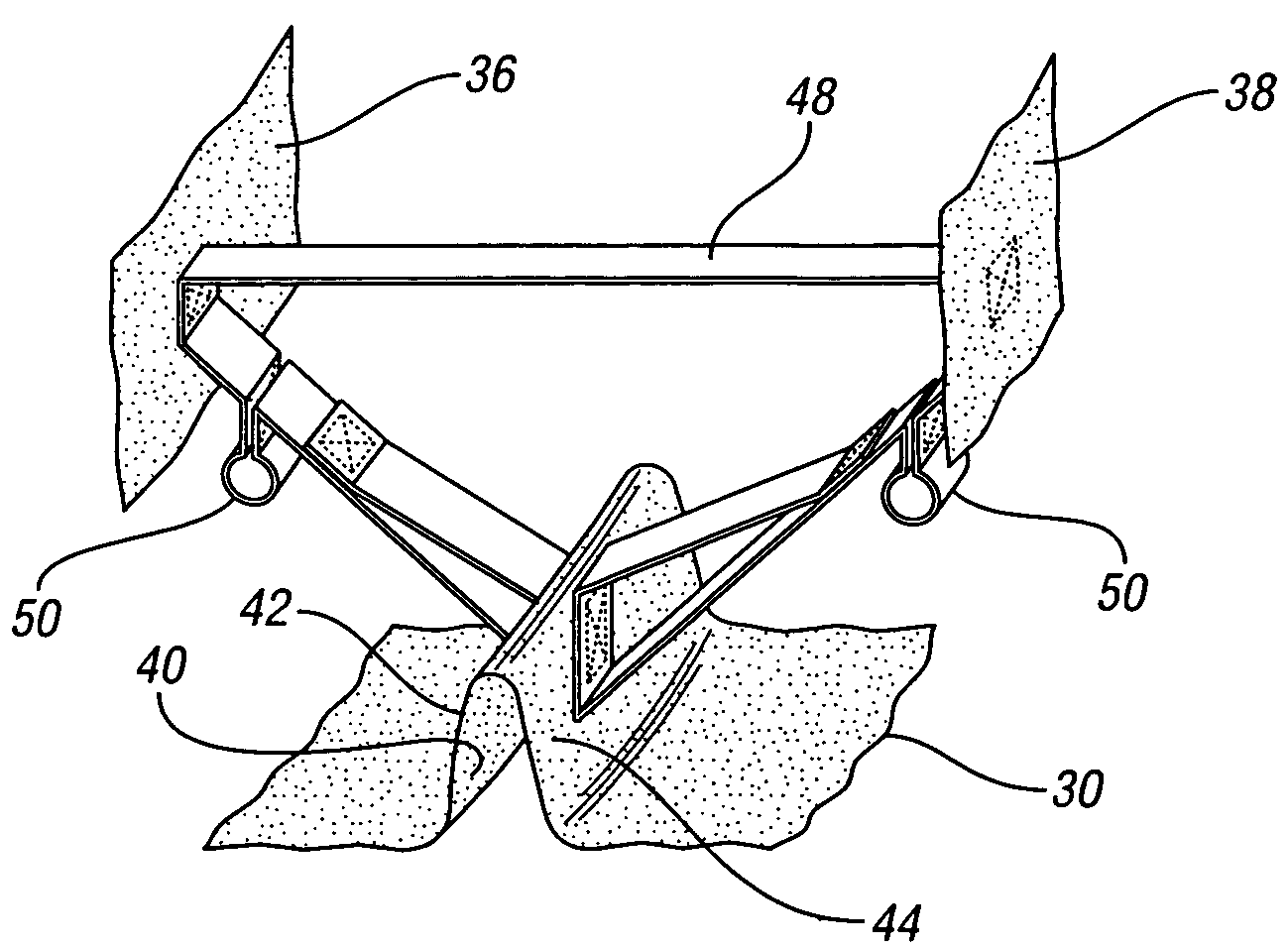 Air bag with a supported channel