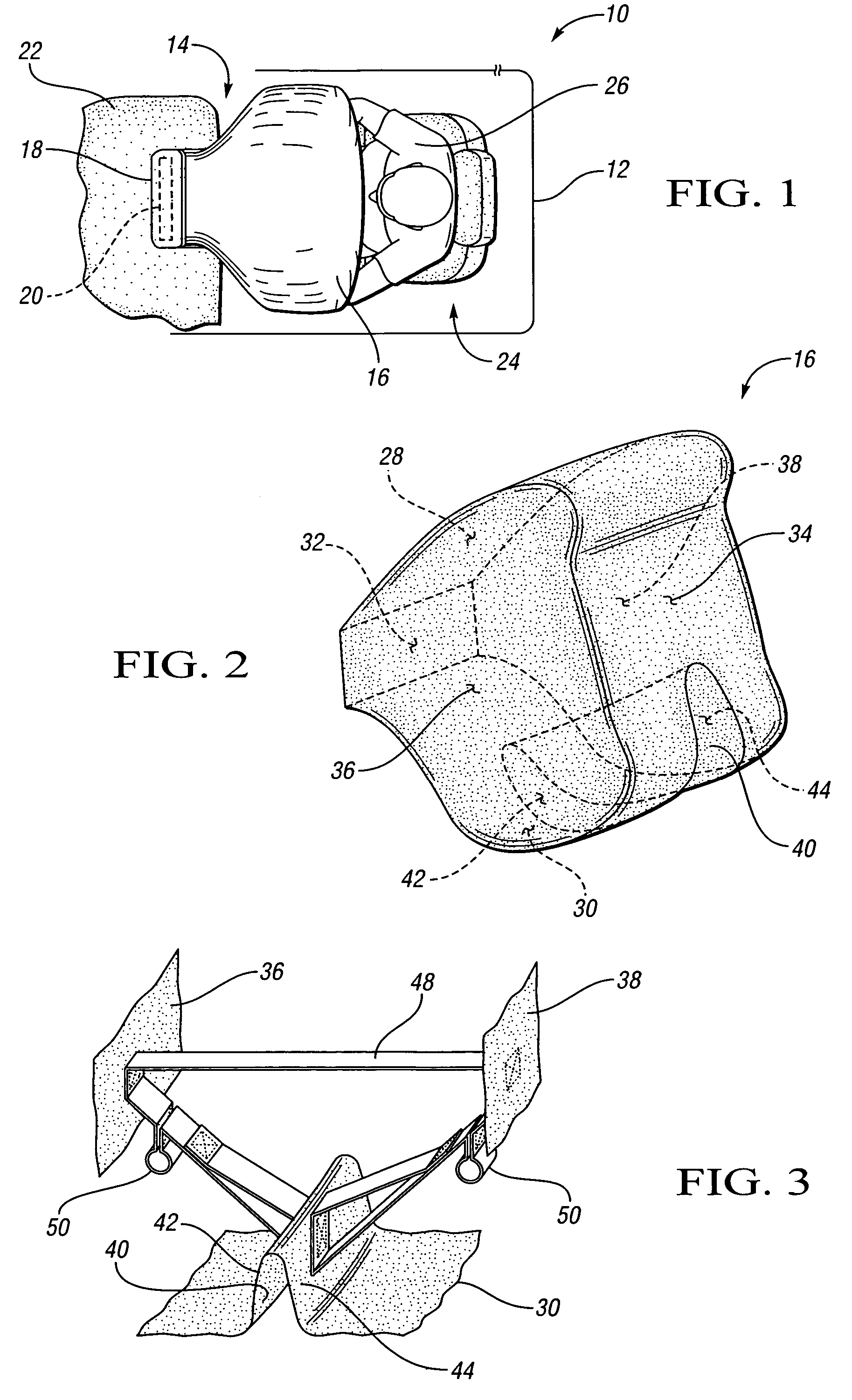 Air bag with a supported channel