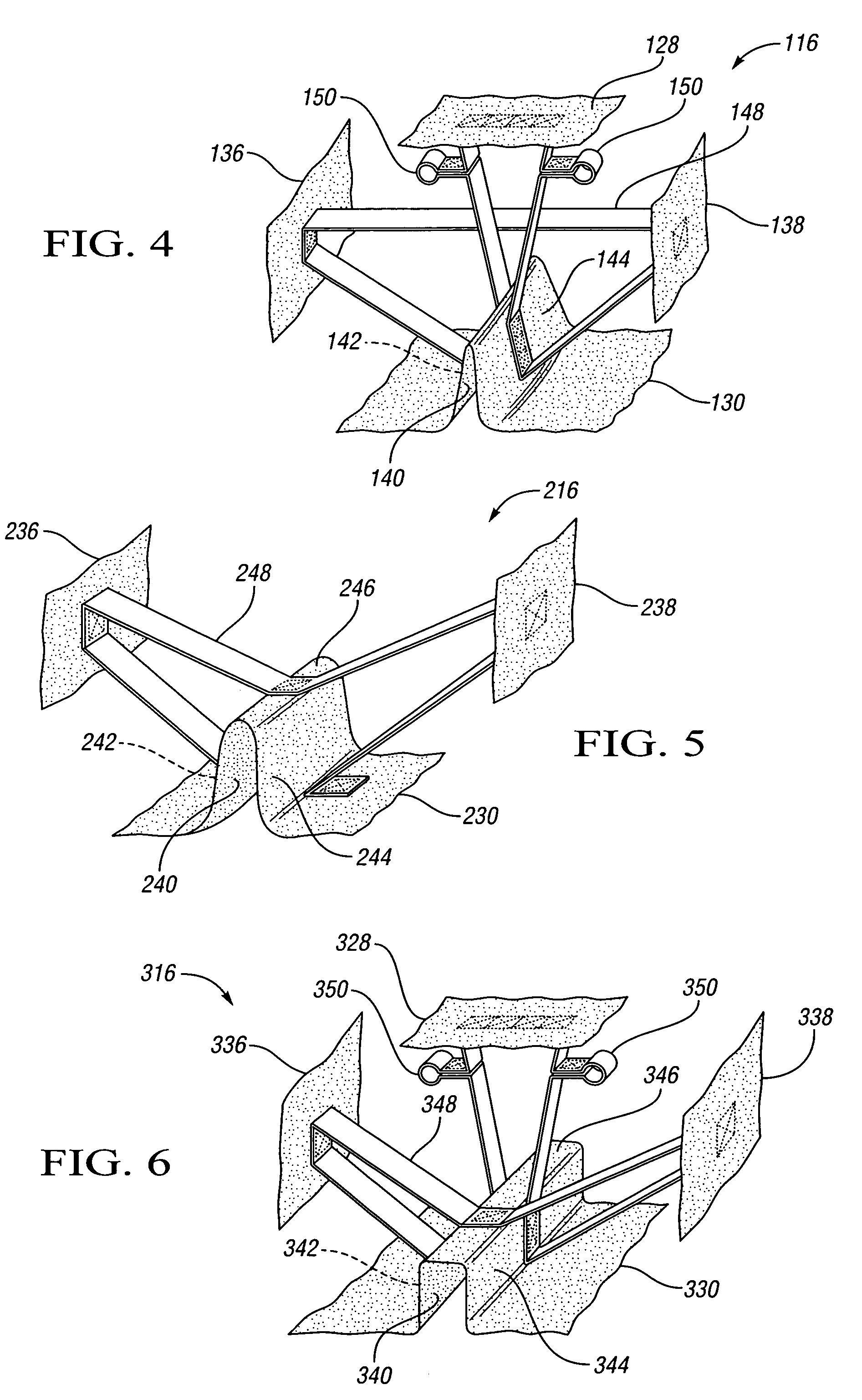 Air bag with a supported channel