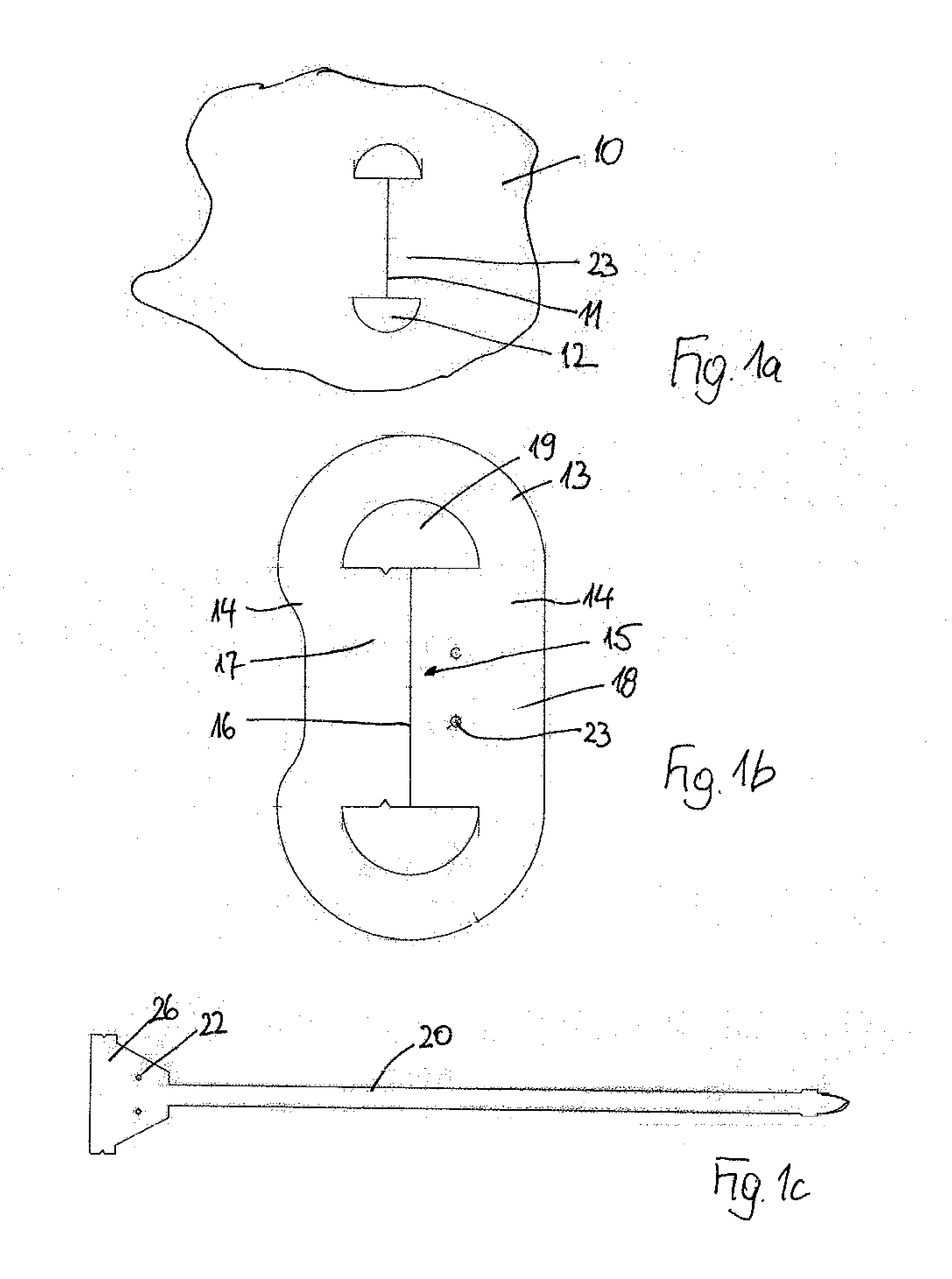 Airbag Module With an Airbag Exhibiting a Vent Opening Closed in the Folded State by an Arrester Strap and Procedure of its Manufacture