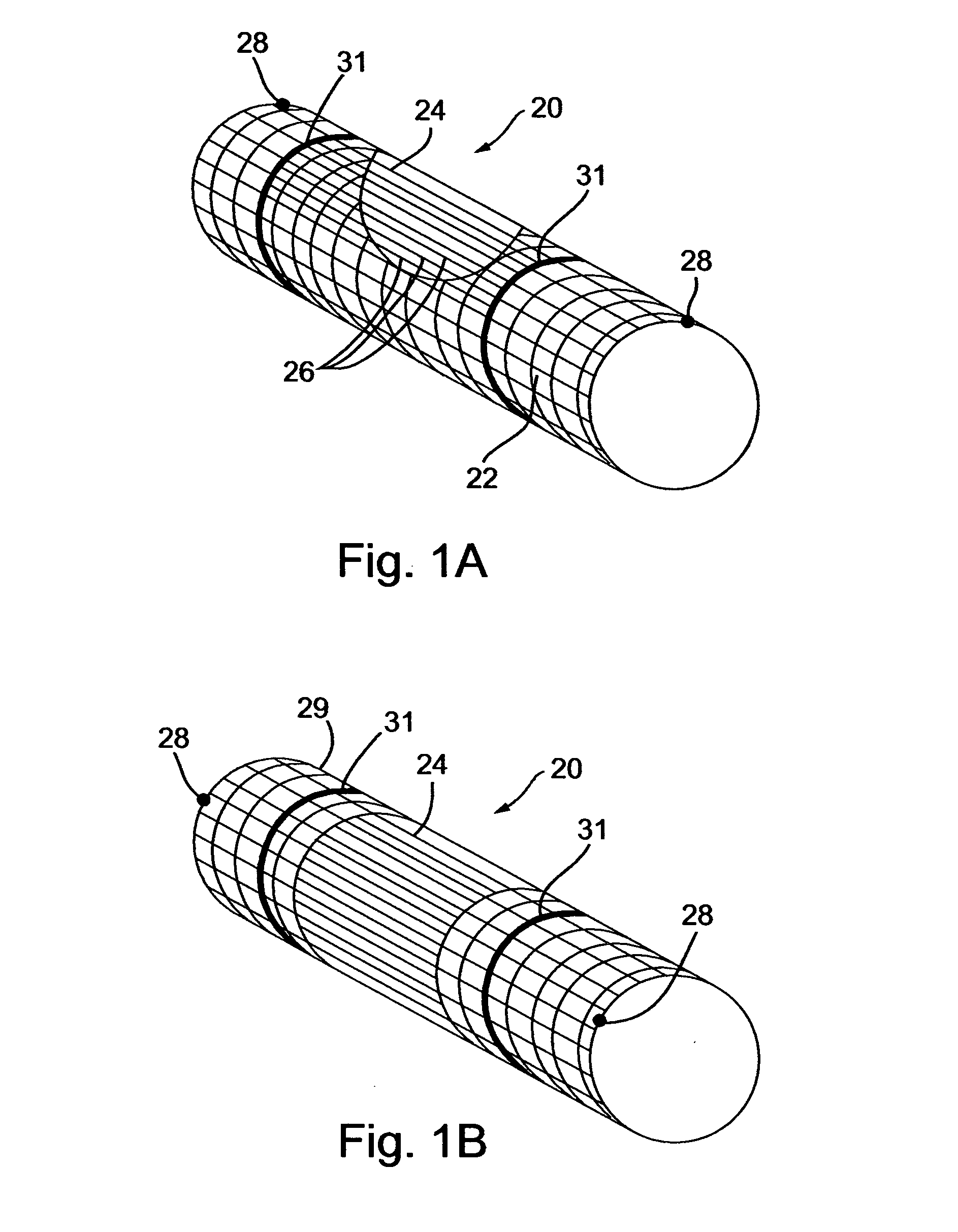 Implantable composite device and corresponding method for deflecting embolic material in blood flowing at an arterial bifurcation