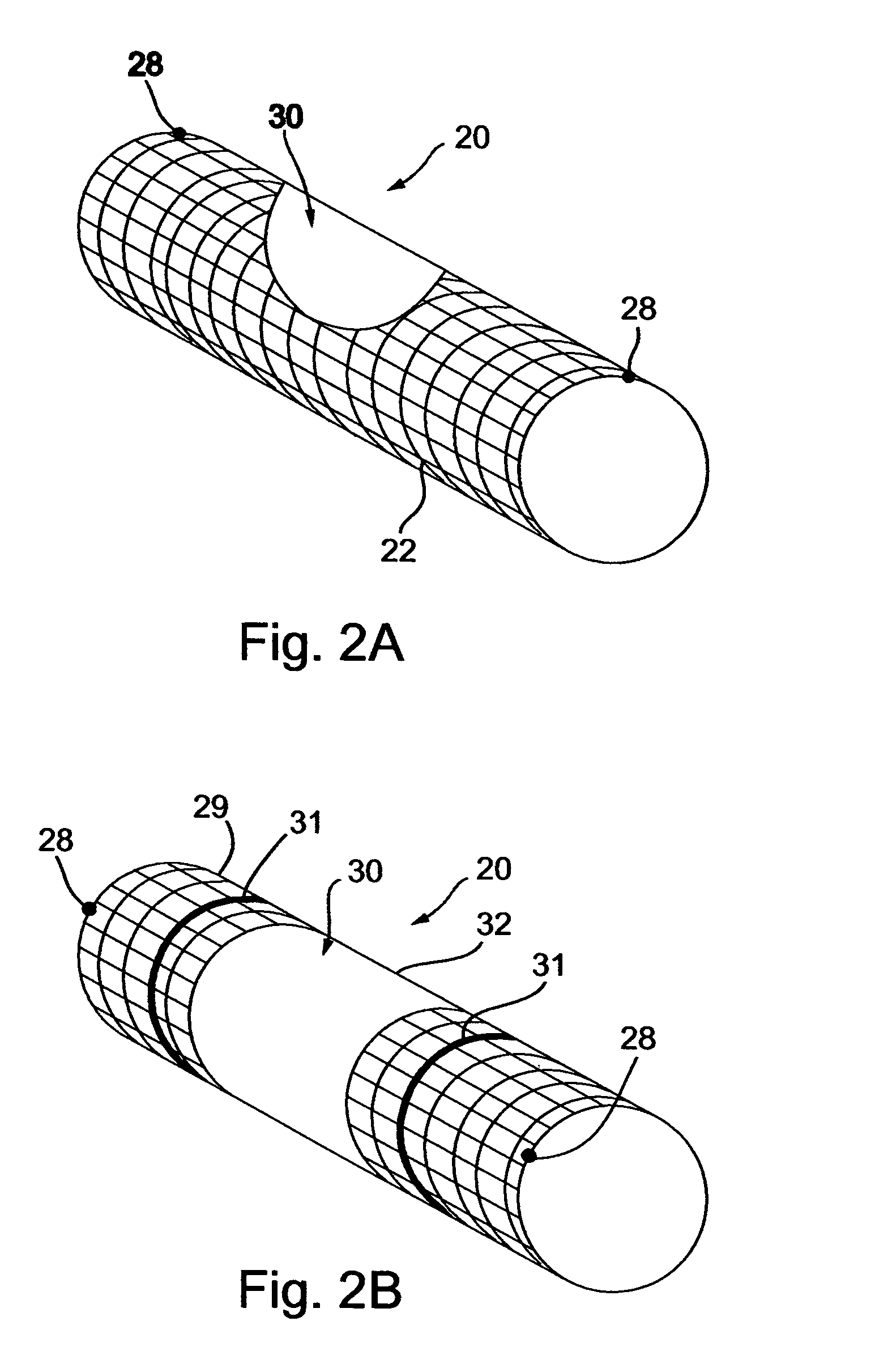 Implantable composite device and corresponding method for deflecting embolic material in blood flowing at an arterial bifurcation
