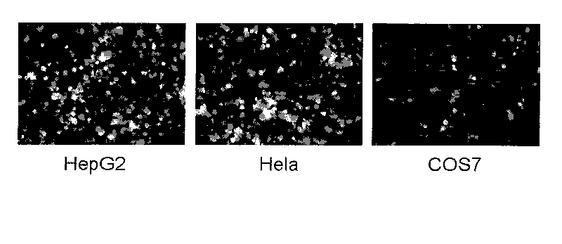 Compound of tumor targeted nonviral gene vector and plasmid DNA and preparation method thereof