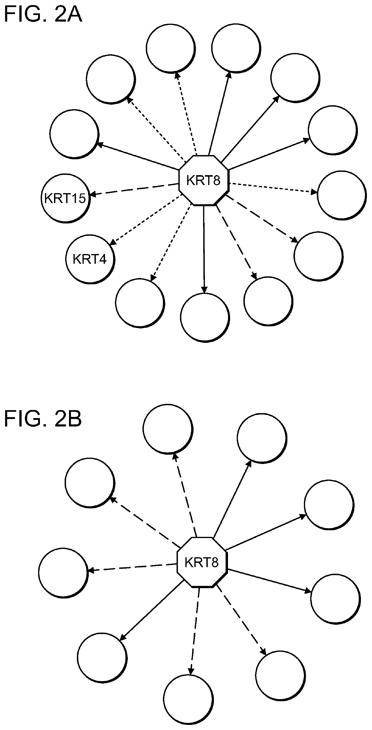 Use of markers including filamin A in the diagnosis and treatment of prostate cancer