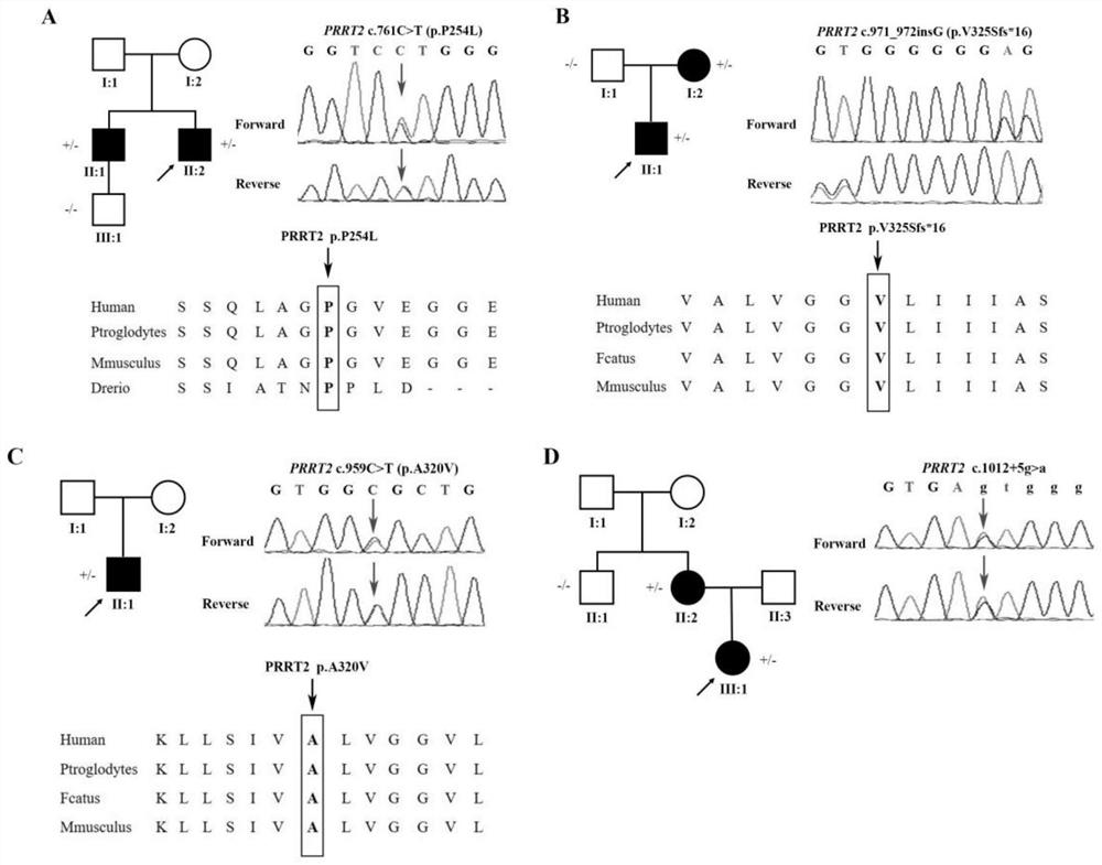 Gene mutation targets related to paroxysmal movement-induced dyskinesia and its application