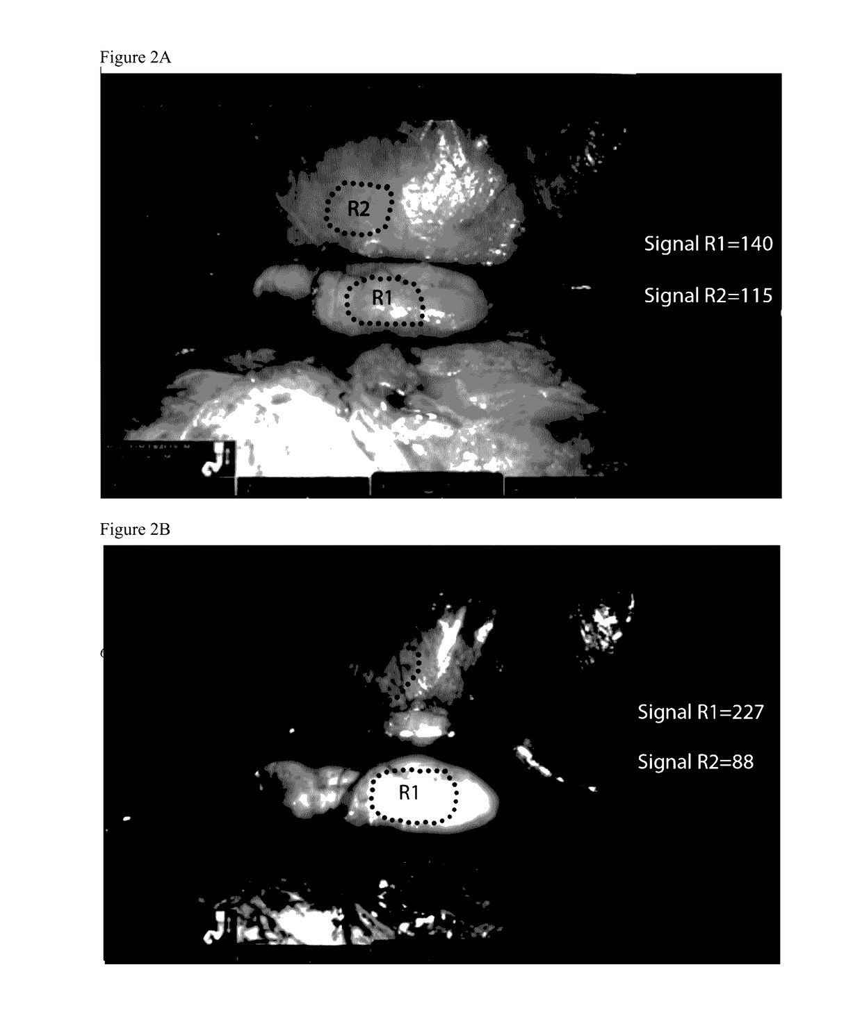 Pharmaceutical compositions of near ir closed chain, sulfo-cyanine dyes