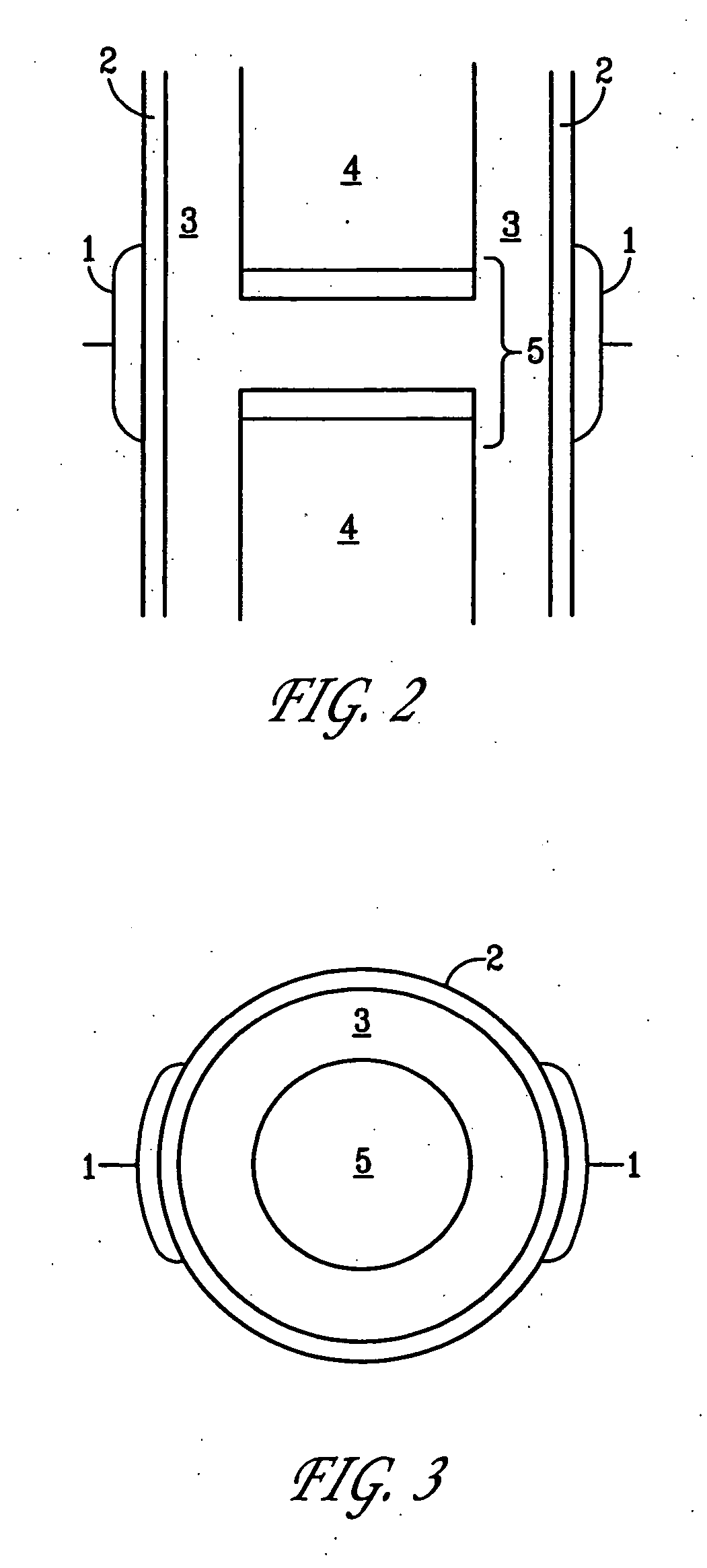 Method and device for treating osteoarthritis, cartilage disease, defects and injuries in the human knee