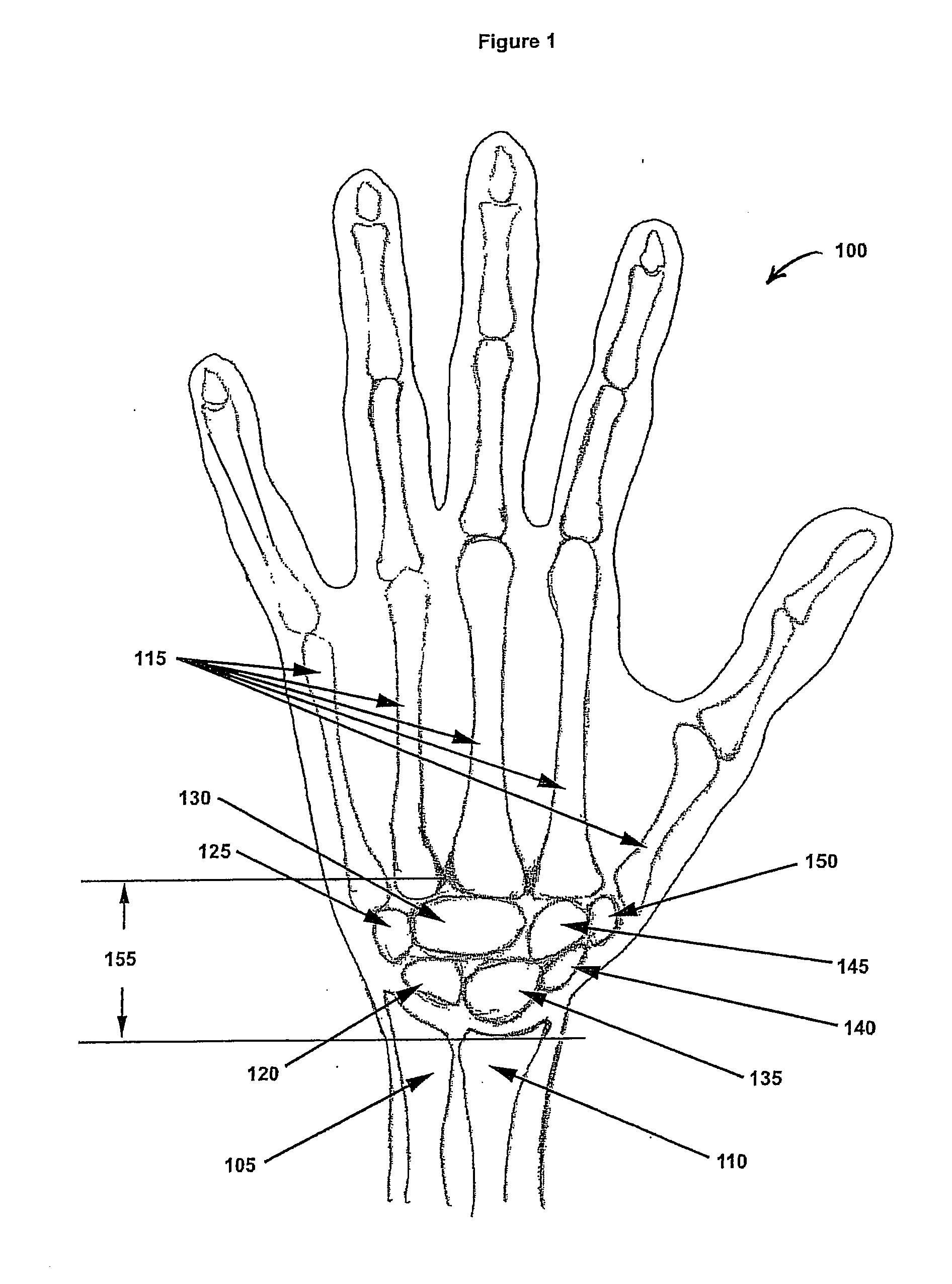 System and method for simultaneously applying a plurality of therapeutic modalities to treat carpal tunnel syndrome