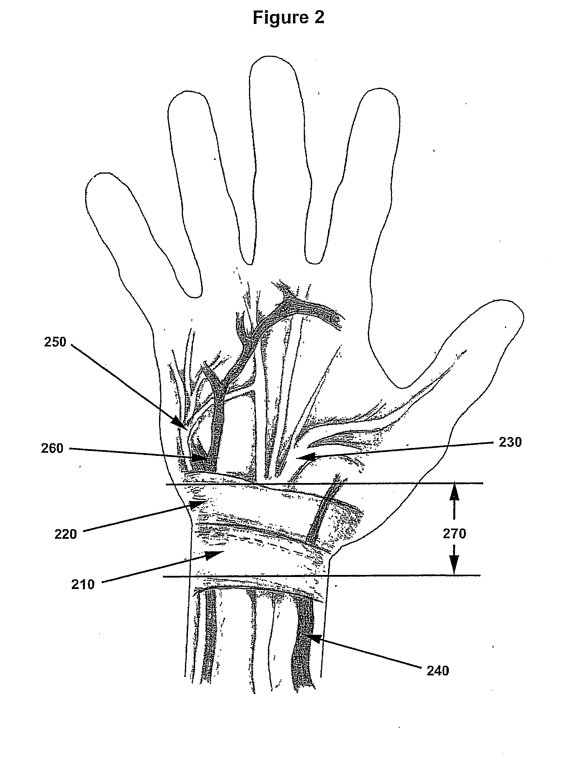 System and method for simultaneously applying a plurality of therapeutic modalities to treat carpal tunnel syndrome