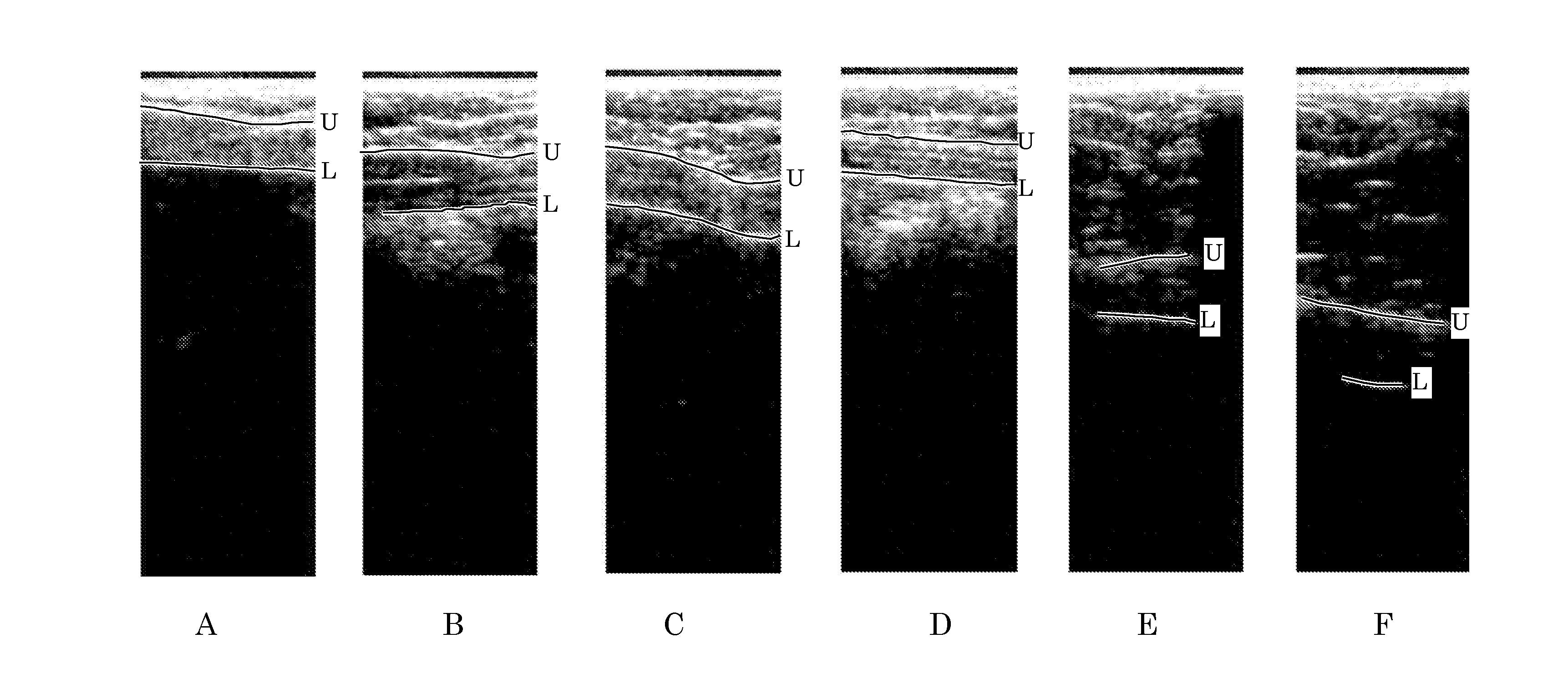 Orientation-Aware Average Intensity Histogram to Indicate Object Boundary Depth in Ultrasound Images