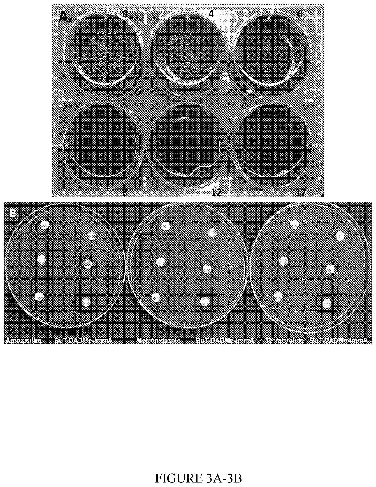 Treatment of helicobacter pylori infections