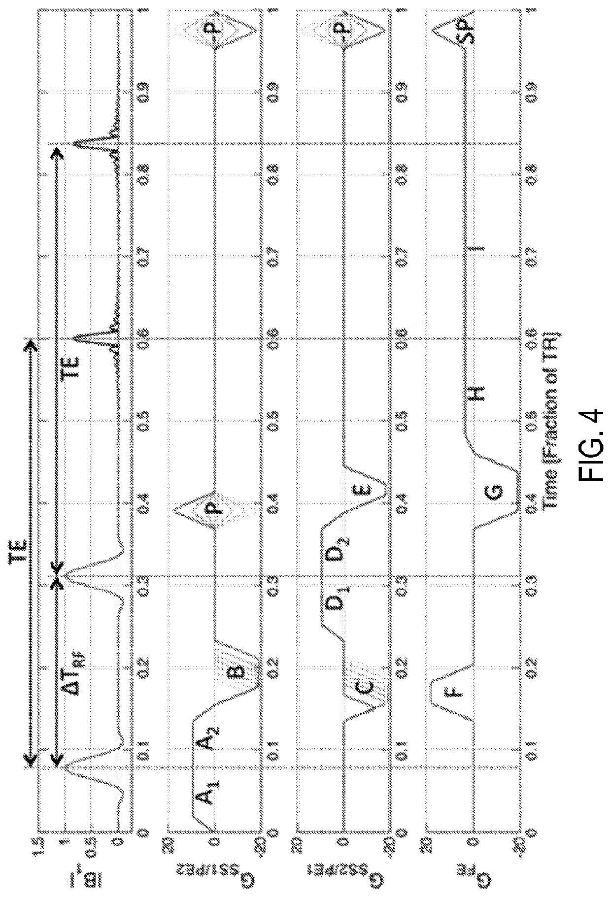 Systems and methods for motion management in magnetic resonance imaging guided therapies