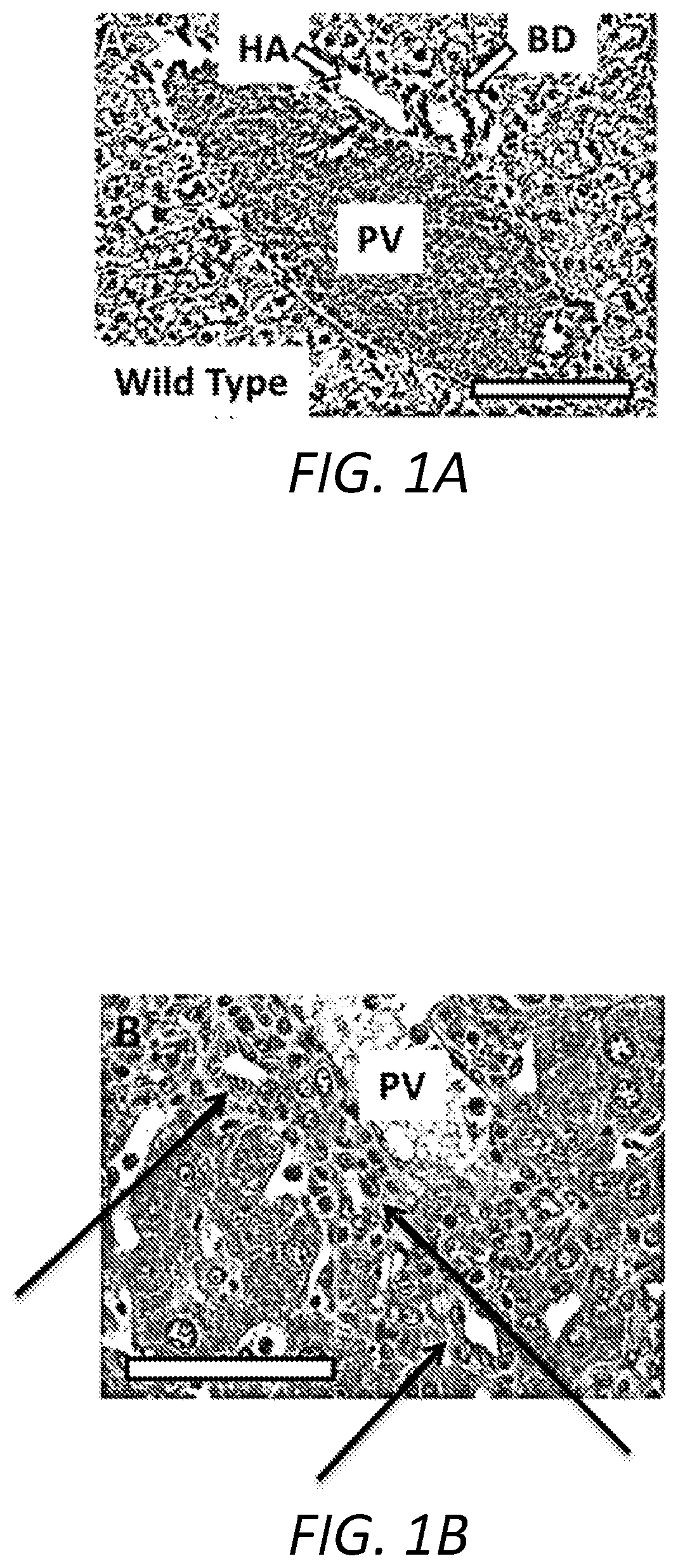 Method for treating primary sclerosing cholangitis