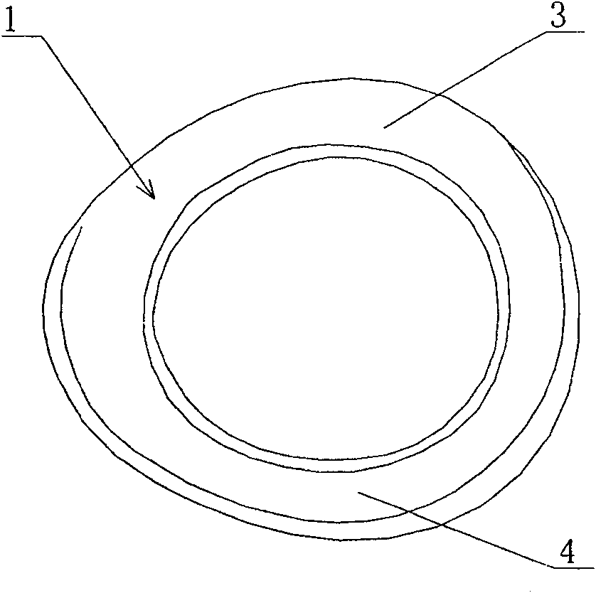 Biological membrane fixing device for eye surface
