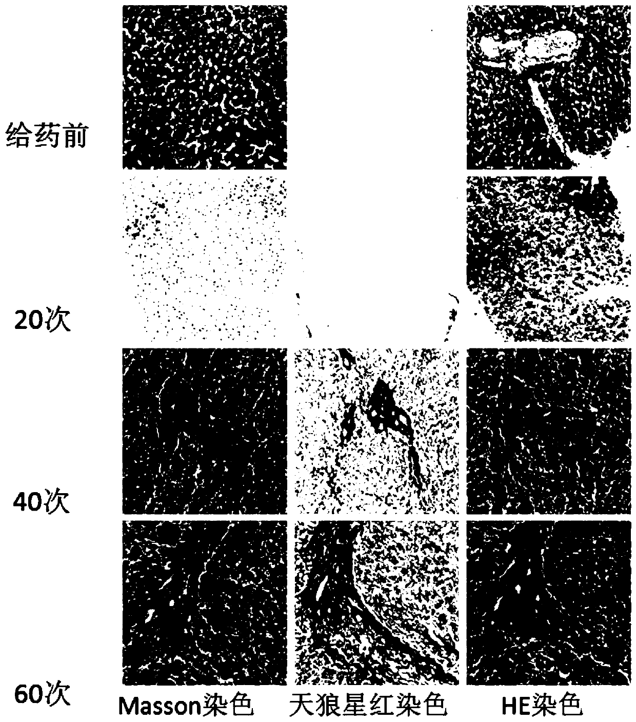 A method for establishing a rhesus monkey liver fibrosis model by intragastric administration