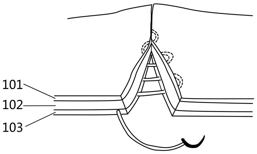 Simulated skin, simulated abdominal wall, training model and preparation method of simulated skin