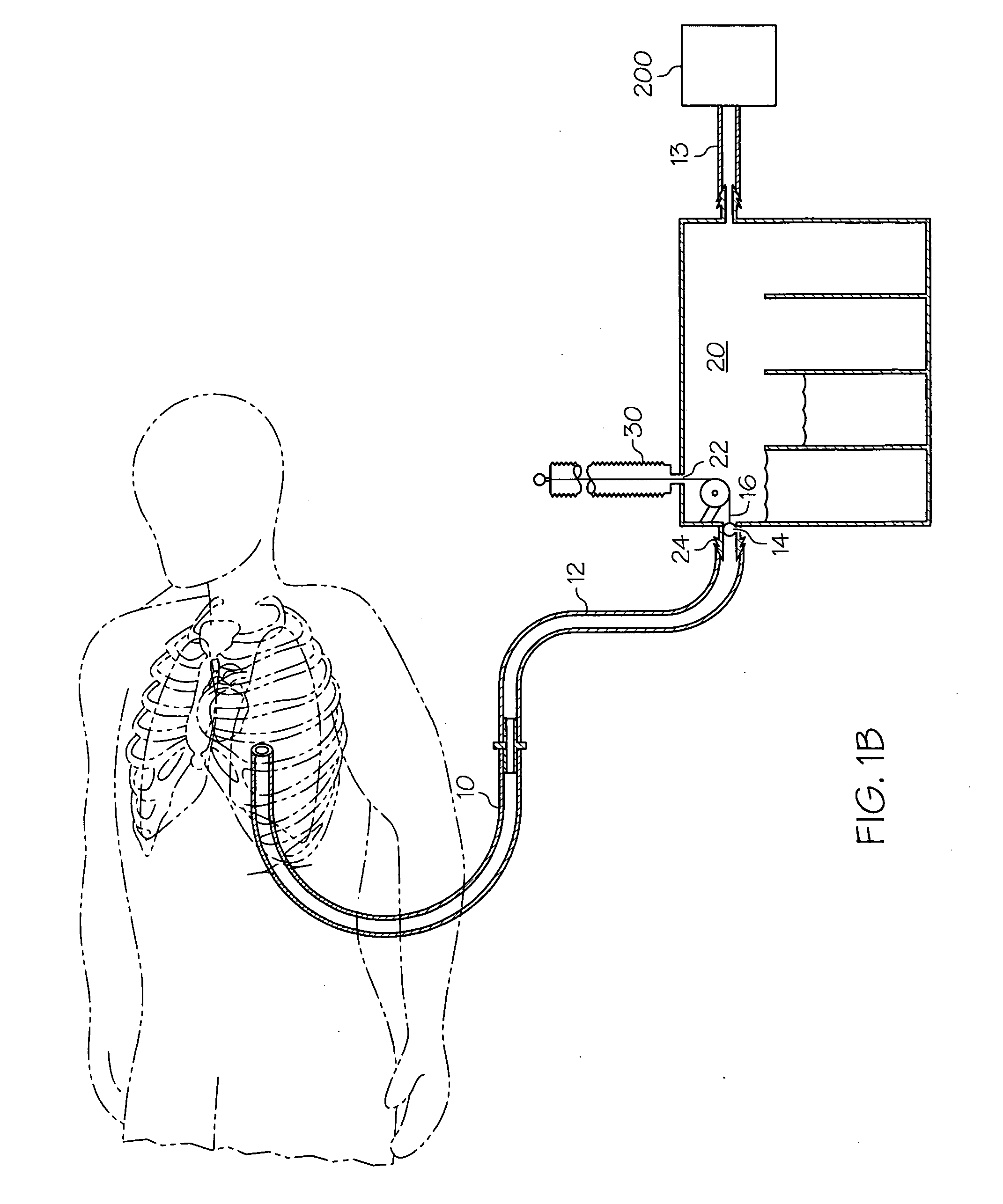 Methods and Devices to Clear Obstructions from Medical Tubes
