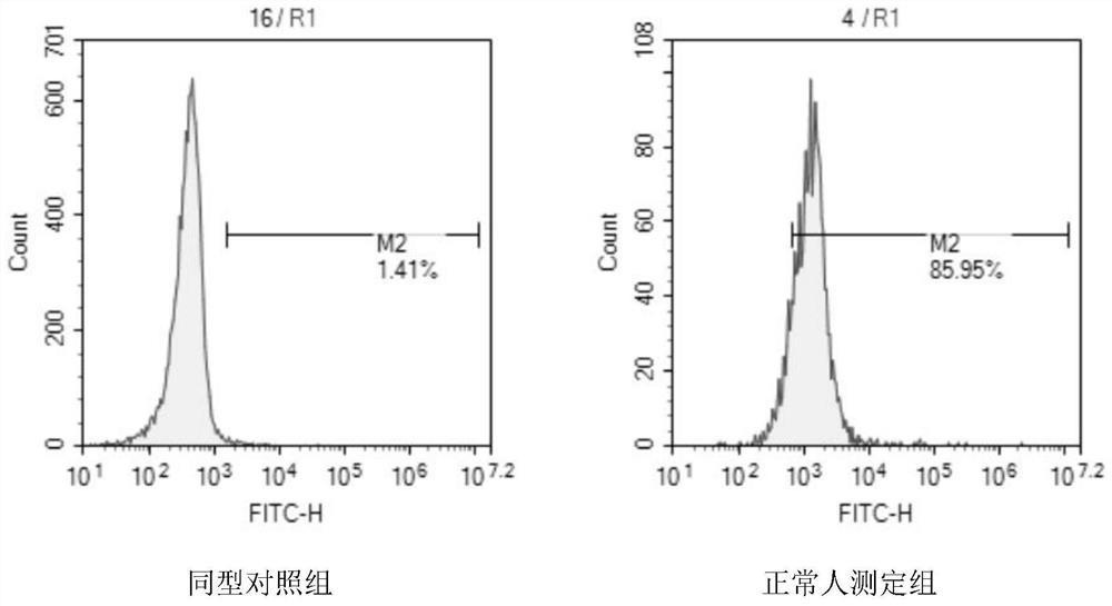 Application of the reagent for detecting the expression of g protein-coupled receptor 18 in the preparation of reagents for sepsis diagnosis, disease course monitoring and prognosis judgment