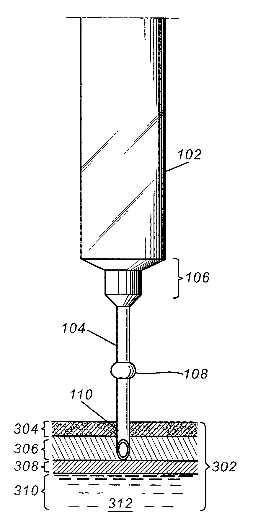 Apparatuses and methods for transcleral cautery and subretinal drainage