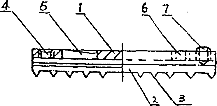 Centering joining tooth type coaptation plate