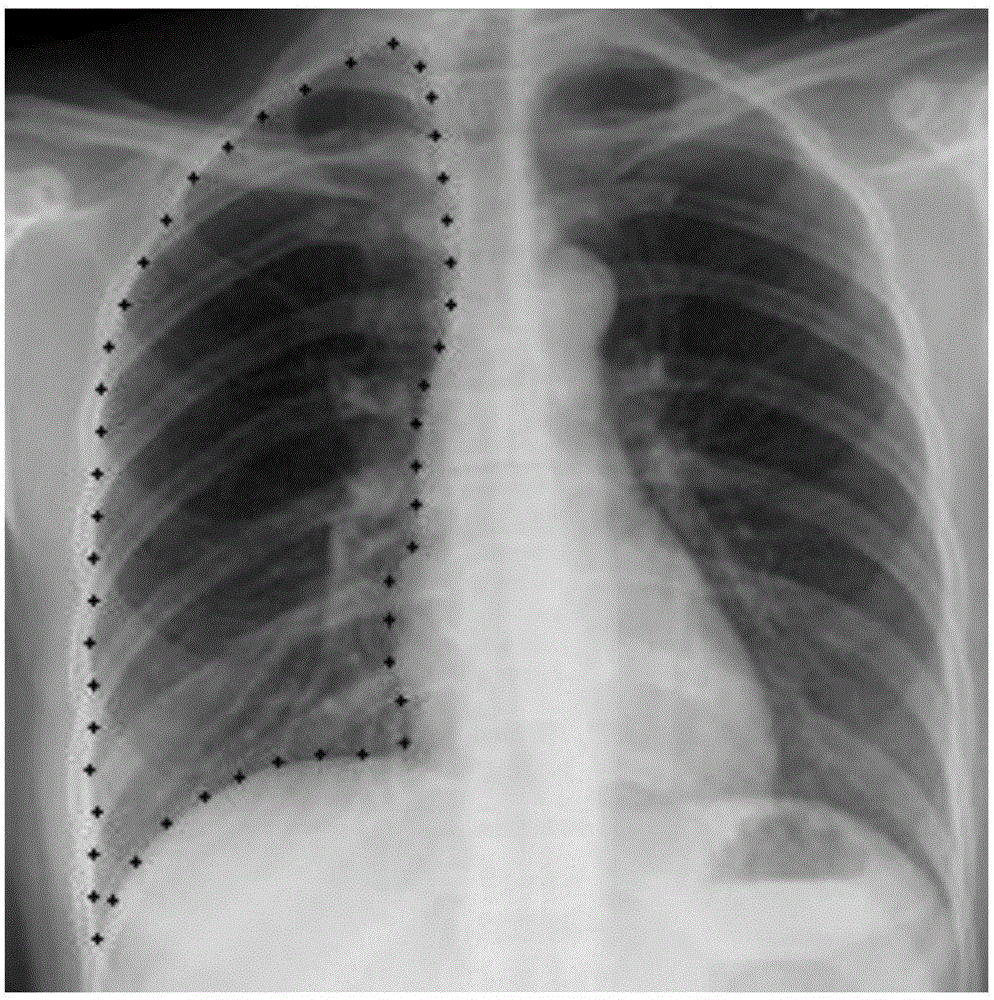 An efficient medical image segmentation method based on game framework