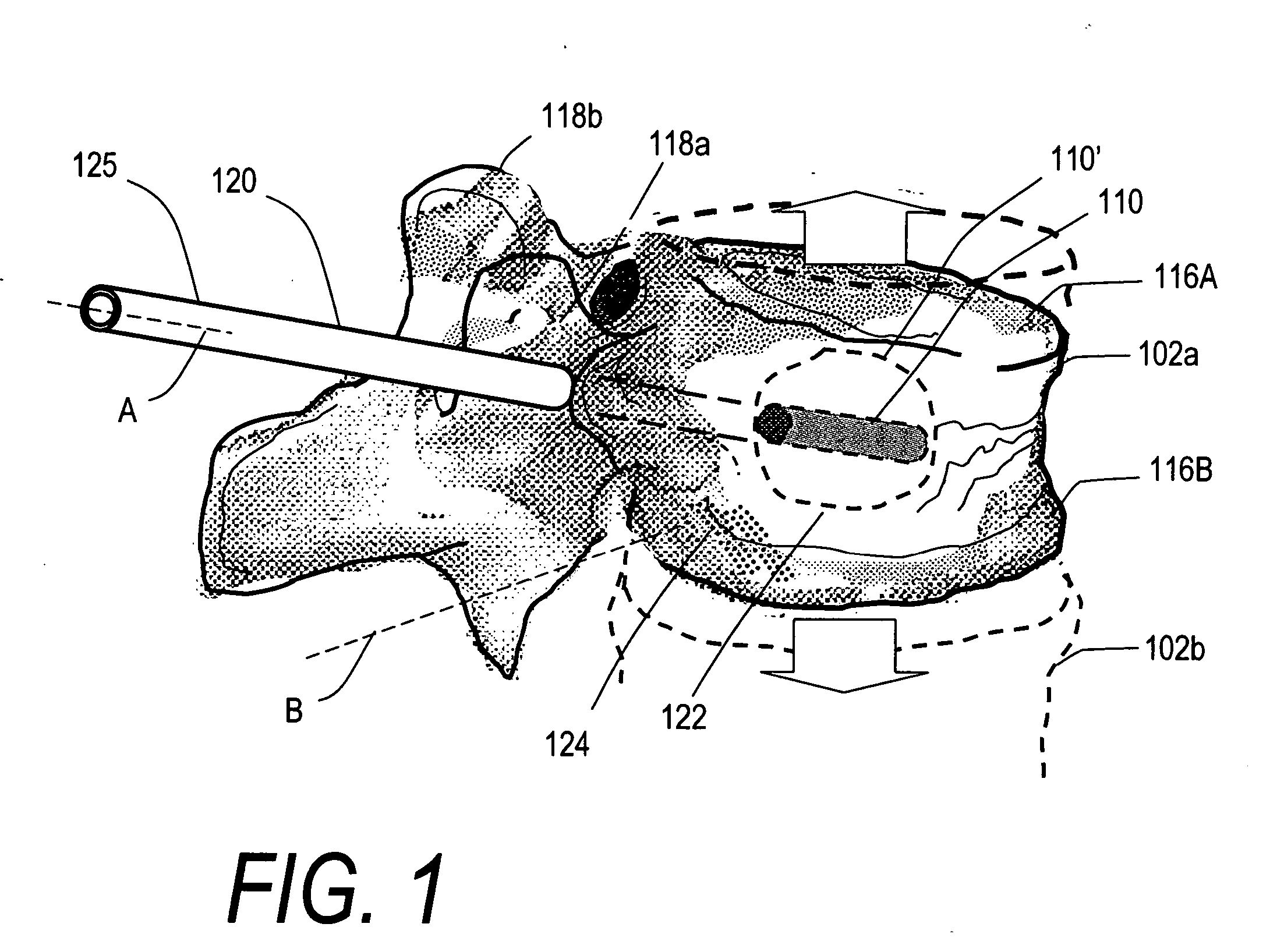 Biomedical treatment systems and methods