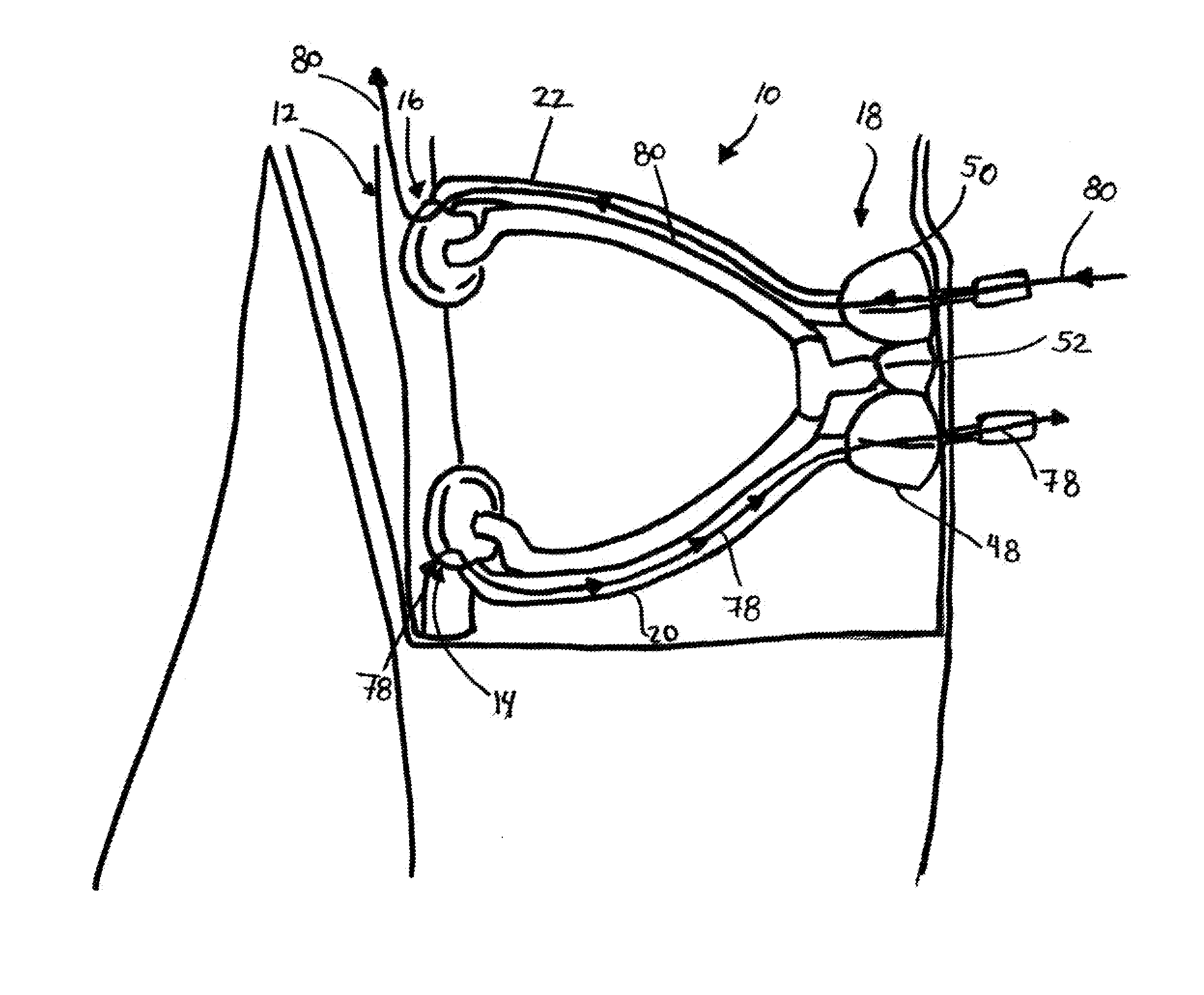 Hemodialysis access port and cleaning system