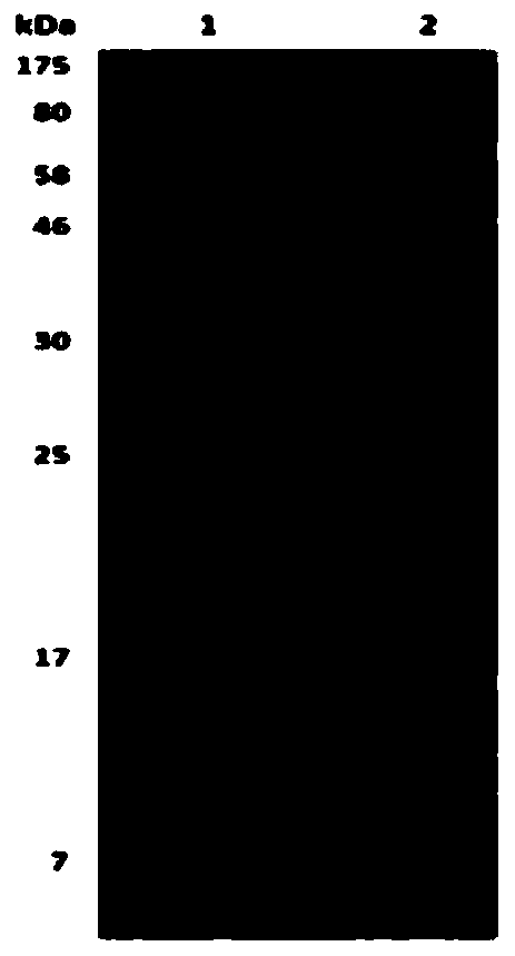 Coxsackie virus group A 16-type monoclonal antibody 16E1 and preparation method thereof